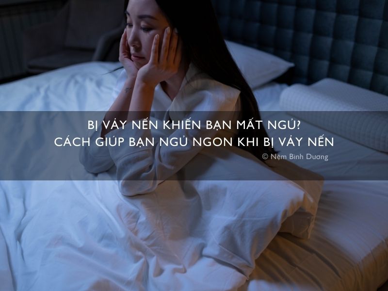 Bị vảy nến khiến bạn mất ngủ? Cách giúp bạn ngủ ngon khi bị vảy nến