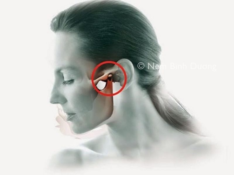 Ngủ dậy bị sái quai hàm phải làm sao? Hướng dẫn cách chữa trị hiệu quả