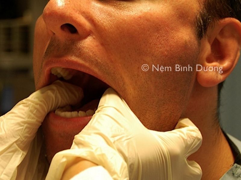 Ngủ dậy bị sái quai hàm phải làm sao? Hướng dẫn cách chữa trị hiệu quả