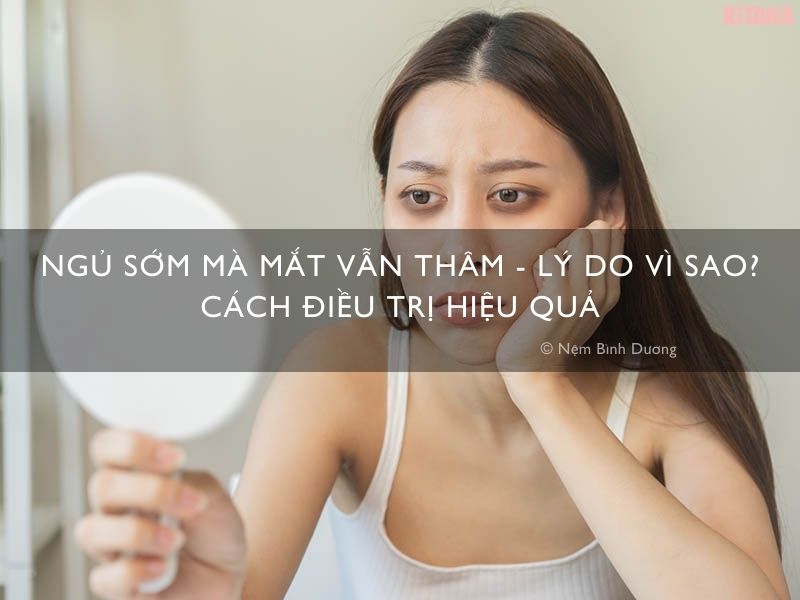 Ngủ sớm mà mắt vẫn thâm - Lý do vì sao? Cách điều trị hiệu quả