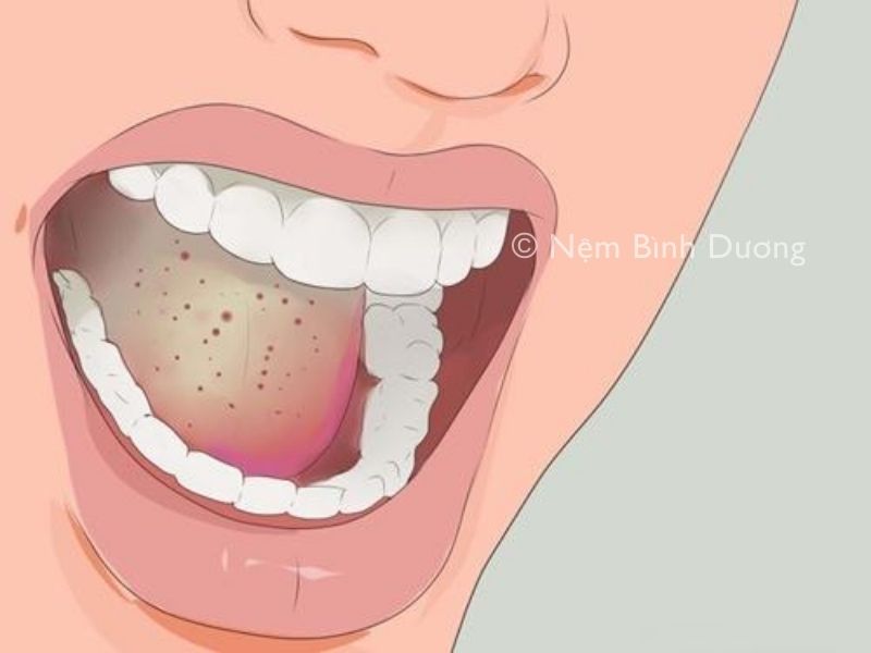 Sáng ngủ dậy nước bọt có màu vàng - Cảnh báo sức khoẻ