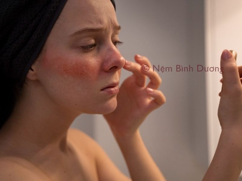 Lưu ý khi chườm đá lên mặt