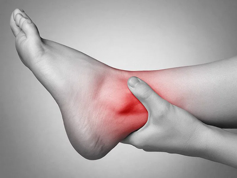 Nguyên Nhân Ngủ Dậy Bị đau Khớp Cổ Chân