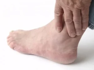 Ngủ Dậy Bị đau Mắt Cá Chân Nguyên Nhân Và Cách Sơ Cứu