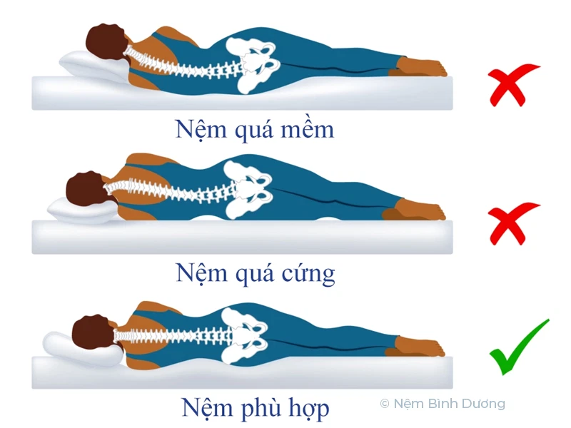 Chọn Nệm Cho Người đau Cột Sống: Hướng Dẫn Chọn Nệm đúng Cách Giúp Giảm đau Và Nâng Cao Giấc Ngủ